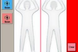 A new report from the American Association of Physicists in Medicine has found that radiation exposure risk from backscatter body scanners is negligible. A new report from the American Association of Physicists in Medicine has found that radiation exposure risk from backscatter body scanners is negligible.