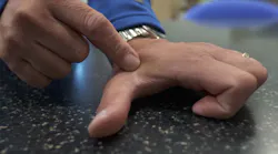 Three Square Market (32M) recently offered implantable RFID chip technology to its employees.